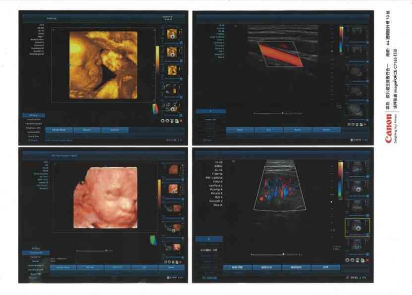 佳能打印机怎么样 名副其实的办公室文印中心 佳能彩色数码复合机imageFORCE C7165评测